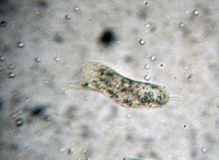 Prove di identificazione di protozoo: Spiretella plancticola